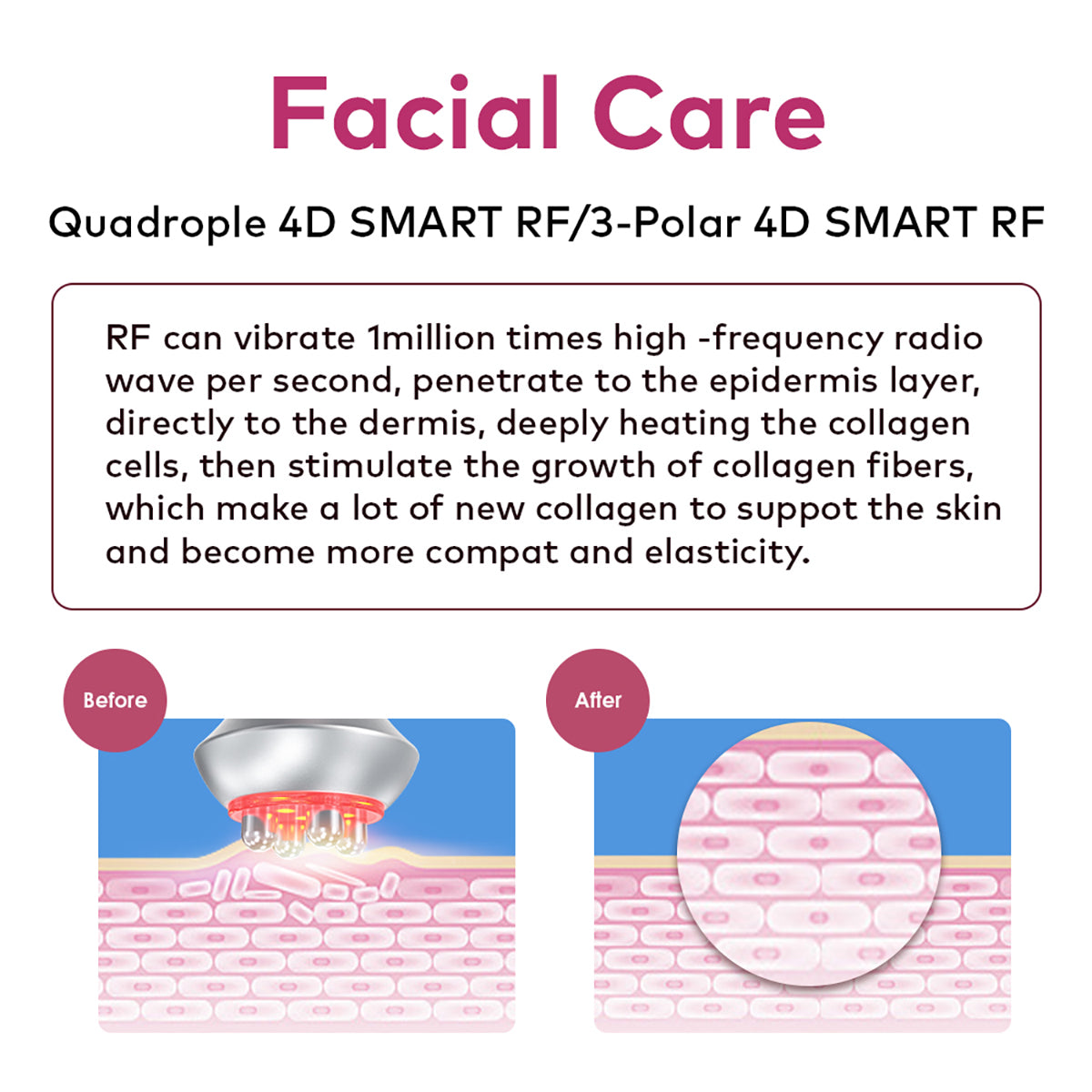 SQ90E Plus 9-in-1 80K Ultrasonic Cavitation & RF Machine with Laser + Microcurrent Pads