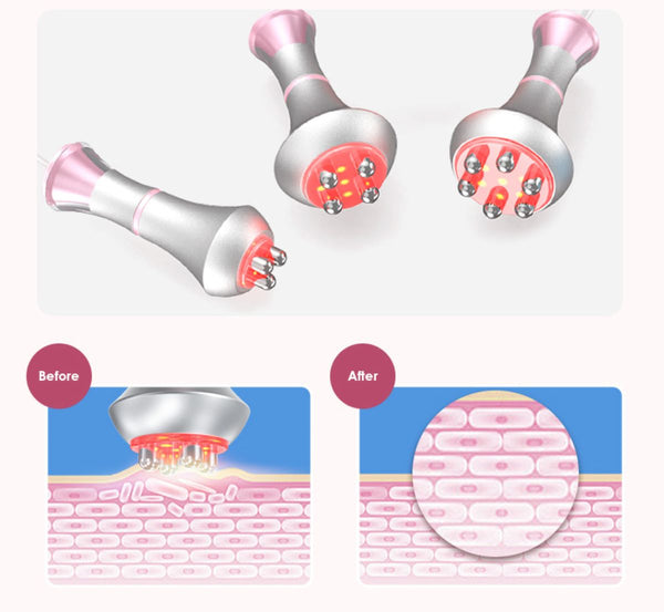SQ121A Pro, 6in1 Body Sculpting Machine | 80K Cavitation, Multi-Polar RF, Vacuum RF, Laser Body Contouring Pads for Skin Firming Contouring Device