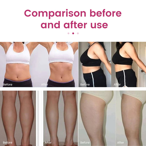 SQ41 7-in-1 40K Cavitation & RF Beauty Machine