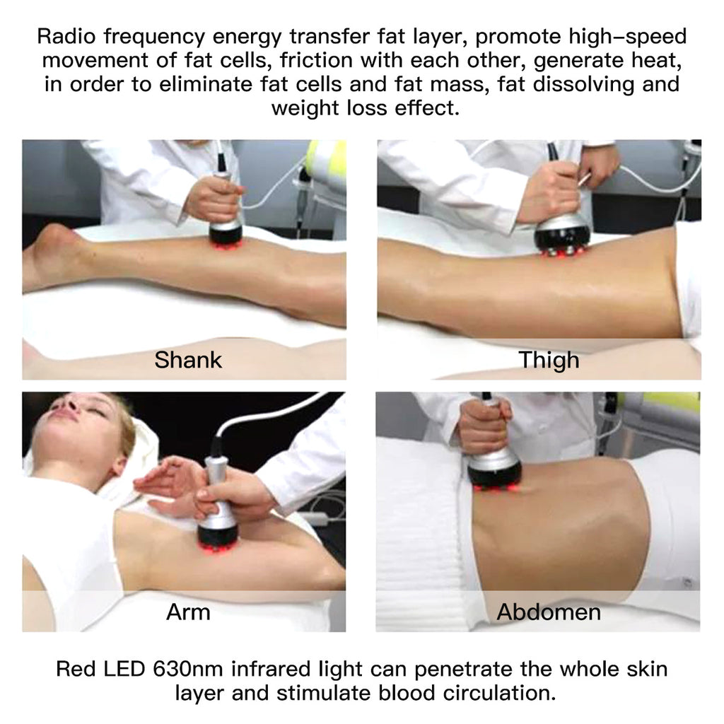 SQ48 Pro 6-in-1 40K Ultrasonic Cavitation & RF Machine with Laser Pads